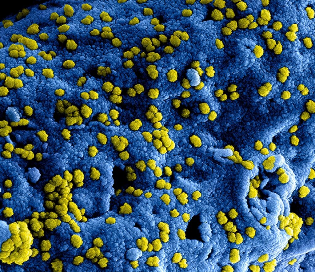 Exploring the Tiny World of Seed Shrimp (Cypris candida)